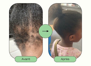 Soin enfant-pousse rapide