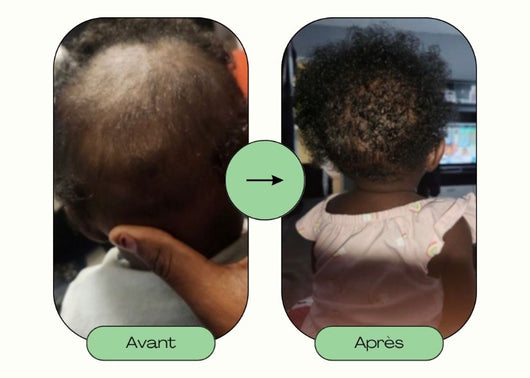 Duo boost pousse – petit format (spécial enfant)