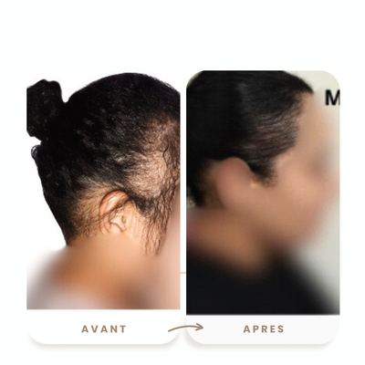 Huile de croissance - boost pousse