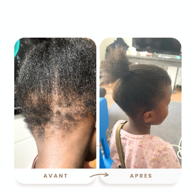 Soin enfant-pousse rapide