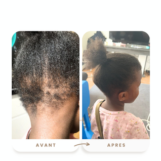 Soin enfant-pousse rapide