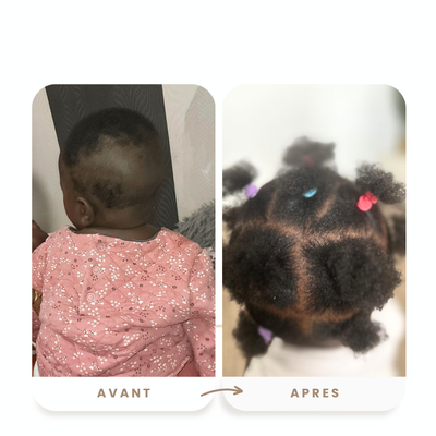 Soin enfant-pousse rapide