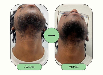 Pousse rapide barbe