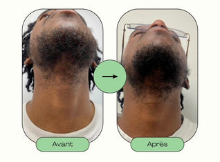 Pousse rapide barbe